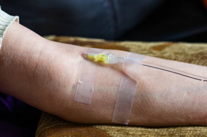 Santé ► La vitamine C réduirait les risques de cancer du poumon, même chez les fumeurs