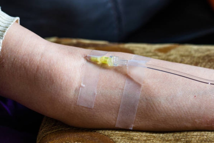 Santé : La vitamine C réduirait les risques de cancer du poumon, même chez les fumeurs
